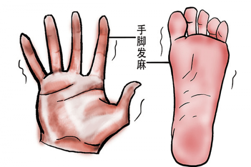 手腳經(jīng)常發(fā)麻是什么原因?手腳發(fā)麻可能患有哪些疾病？